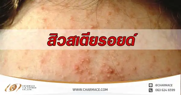 อันตราย !! สเตียรอยด์ (Steroid) ภัยร้ายจากครีมหน้าใสชั่วข้ามคืน