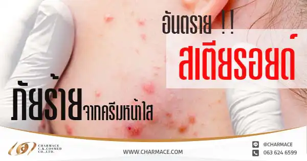อันตราย !! สเตียรอยด์ (Steroid) ภัยร้ายจากครีมหน้าใสชั่วข้ามคืน