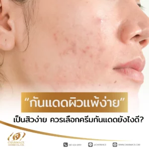 กันแดดผิวแพ้ง่าย เป็นสิว ง่าย ควรเลือกครีมกันแดดยังไงดี?