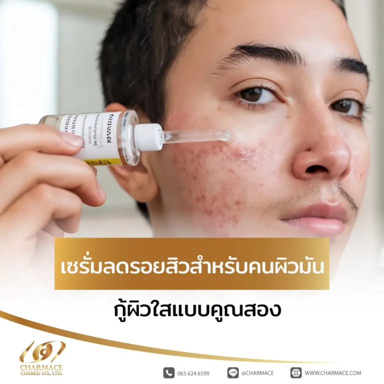 หน้าใสไม่ต้องรอนาน! เซรั่มลดรอยสิวสำหรับคนผิวมัน กู้ผิวใสแบบคูณสอง